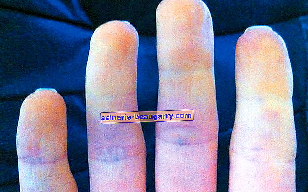 Une poignée de main peut annoncer des maladies importantes